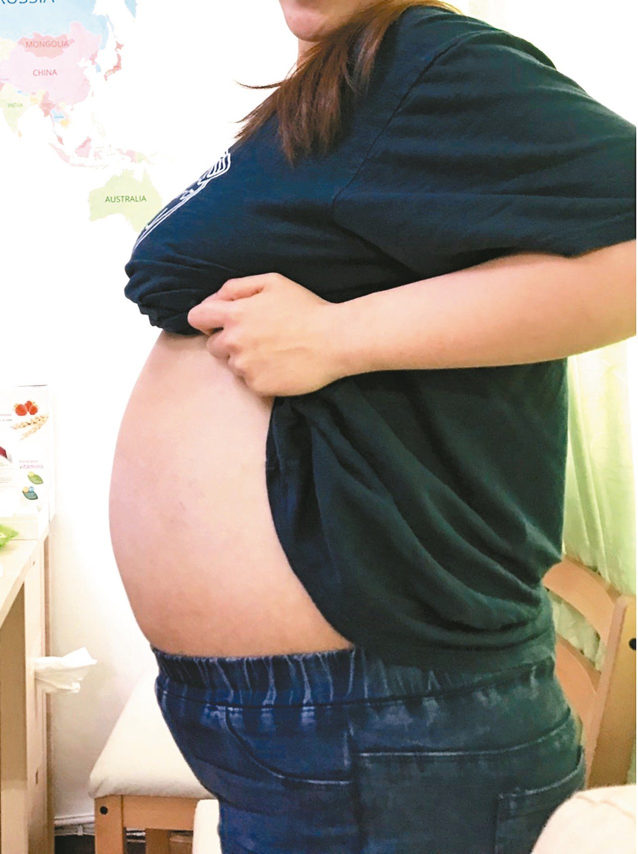 28歲輕熟女減肥卻發現腹部沒瘦，就醫才知輸卵管長了40公分、16公斤的大水瘤。圖為患者術前照片。