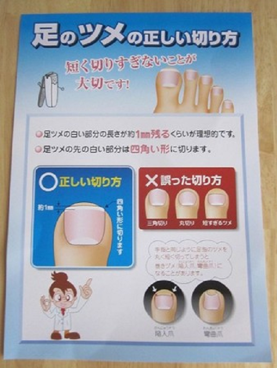 日本診所介紹剪腳指甲的正確方法。