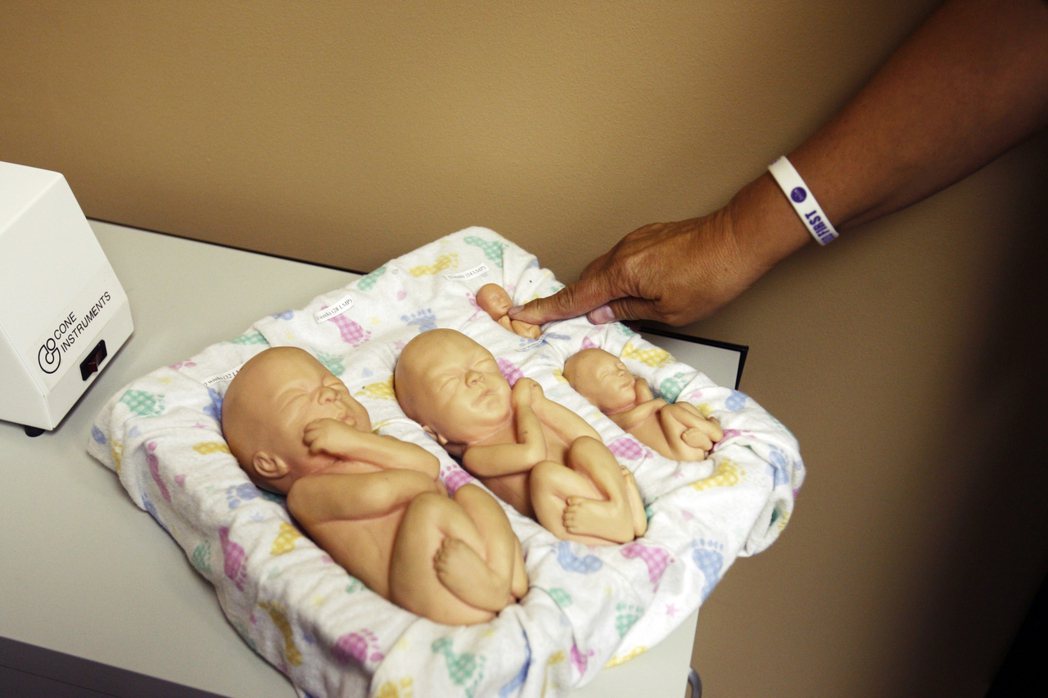 布萊克蒙著名的「三孕期論」：第一孕期（前3個月）因為胚胎尚小，且墮胎的醫療風險極...