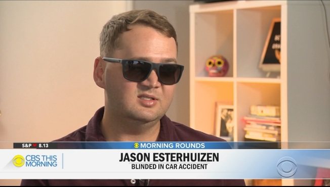 南非青年傑生．艾斯特惠正因車禍造成失明，他來美接受手術，在腦中植入晶片，如今可以分辨光明與黑暗。(CBS新聞)