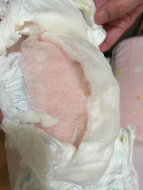 一打開尿布以為寶寶出現血尿，嚇壞了媽媽。圖擷自兒科女醫師艾蜜莉