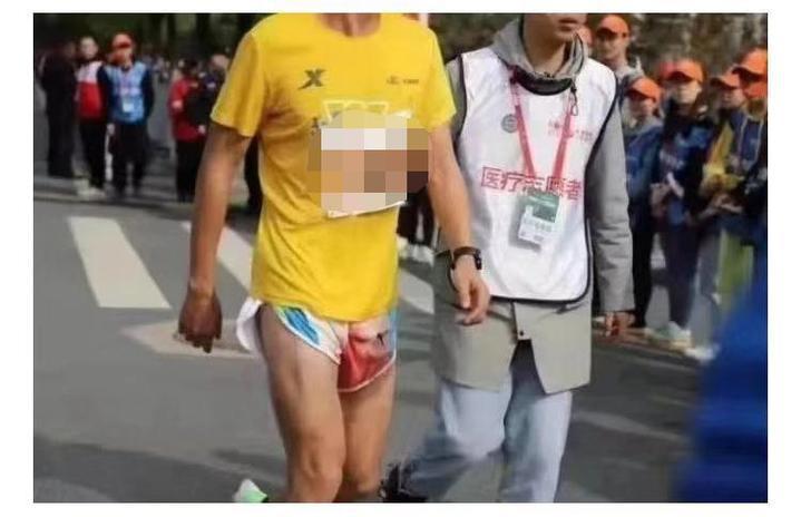 2019襄陽馬拉松有位參賽者下半身摩擦出血。圖取自錢江晚報