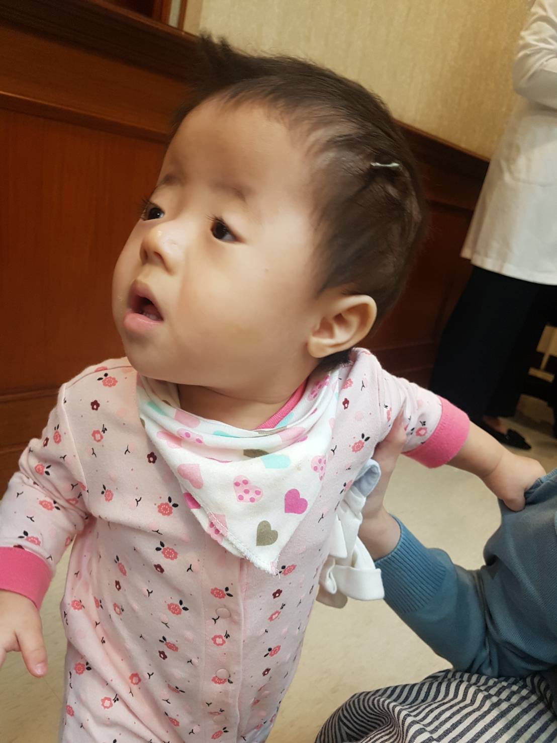 小檸檬在十個月大時接受頭顱擴張牽引手術，媽媽每天要幫她旋轉「螺絲釘」。記者楊雅棠／攝影
