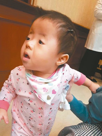 小檸檬在十個月大時接受頭顱擴張牽引手術，媽媽每天要幫她旋轉「螺絲釘」。<br />記者楊雅棠／攝影