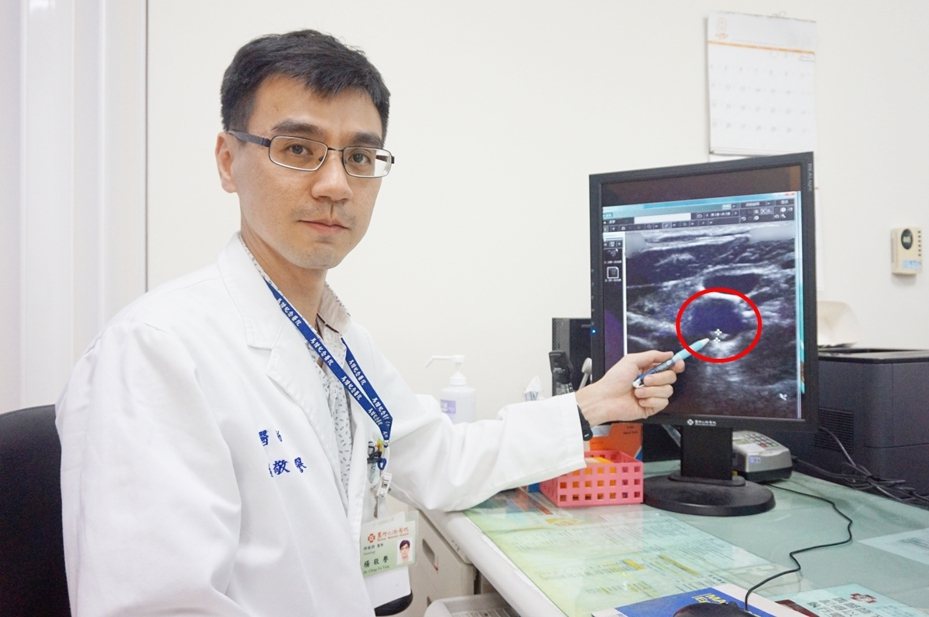 新竹馬偕醫院神經內科醫師楊敬譽表示，紅色圓圈處為病患頸動脈粥樣硬化性斑塊，如置之不理可能引起缺血性腦中風。圖／新竹馬偕醫院提供