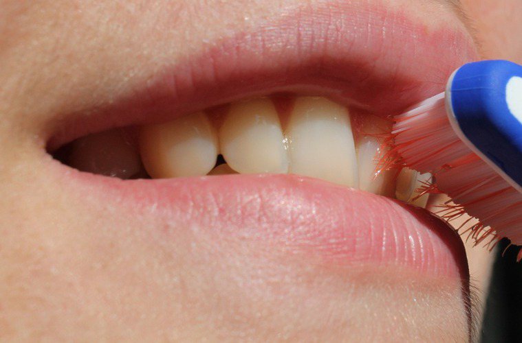 牙周病是引起牙齦出血最常見的原因之一。圖／Pixabay