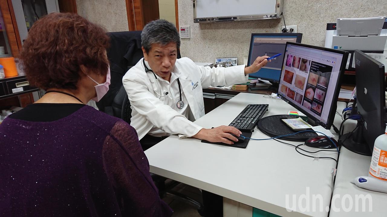 員林市宏仁醫院家醫科醫師曹世達說明帶狀疱疹的發病過程。記者林敬家／攝影