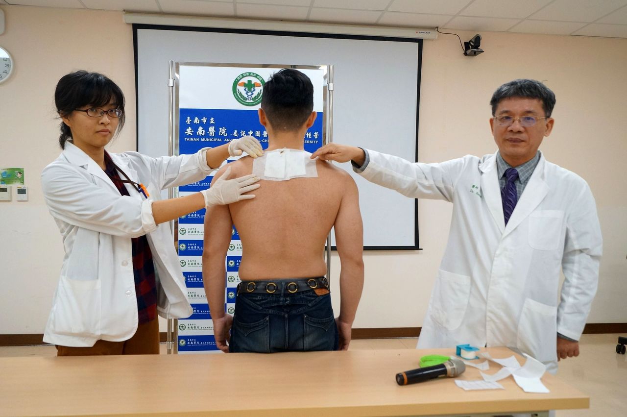 台南市安南醫院中醫部醫師部長黃升騰（右），示範三九貼。圖／安南醫院提供