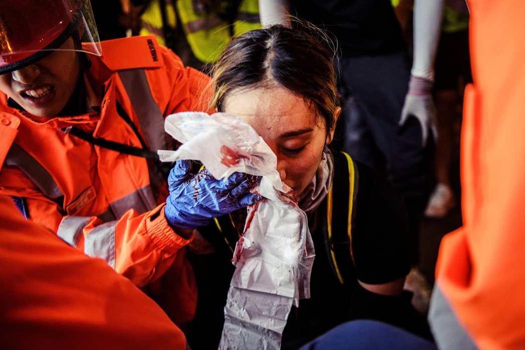 圖為香港8月11日的反送中示威，在尖沙咀一名女性急救員被鎮暴子彈近距離命中面部，...