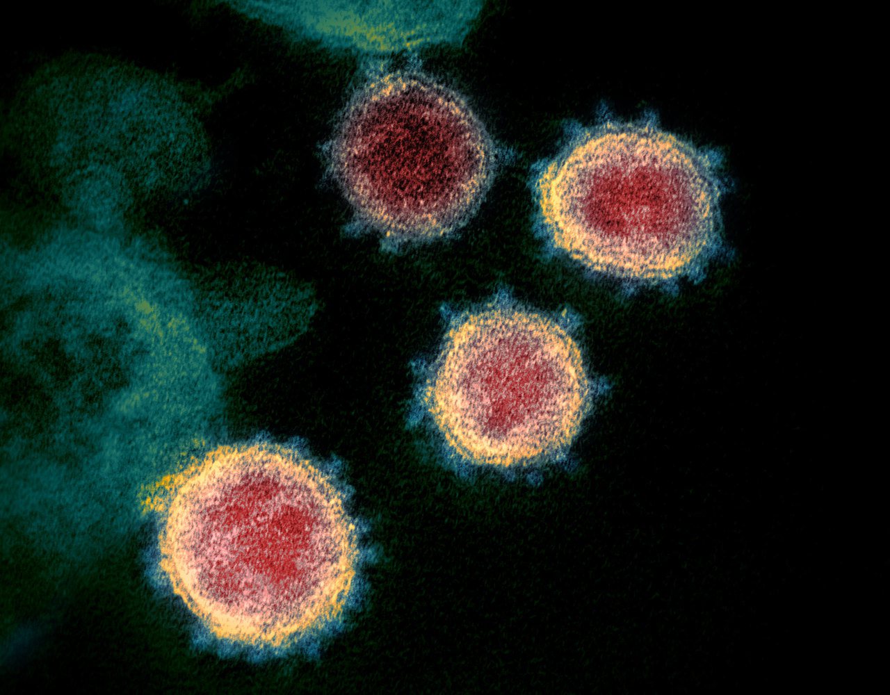 美國國家過敏與感染疾病研究所落磯山實驗室14日釋出新冠肺炎病毒的新影像，可見表面有著尖狀物，才會用拉丁語的「王冠」（Corona）命名。Flickr/NIAID-RML