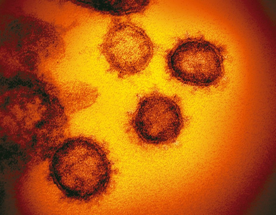 美國國家傳染病研究所日前發布了新冠病毒詳細外觀，與MERS和SARS病毒極為相似。<br />圖／美聯社
