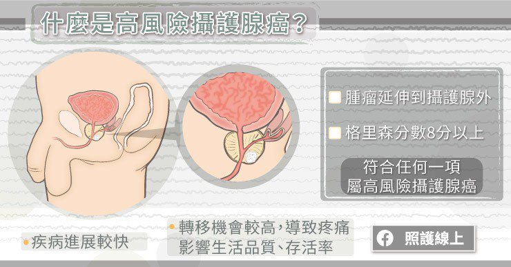 台灣男性第五大癌症！不能輕忽的高風險攝護腺癌