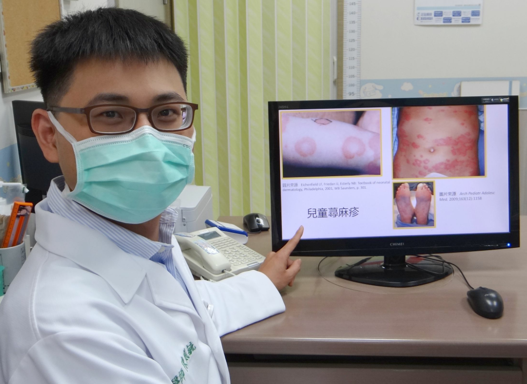 奇美兒科部主治醫師陳威毓指出，這名5歲兒童蕁麻疹一直治不好，住院檢查才知是黴漿菌作怪。圖陳威毓提供