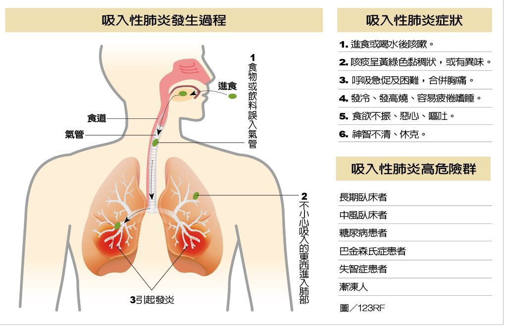吸入性肺炎發生過程  製表/元氣周報  圖/123RF