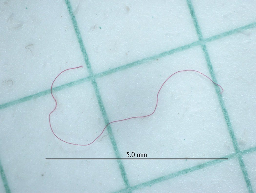 在魚消化道內發現的粉紅塑膠纖維 圖／陳冠如攝影