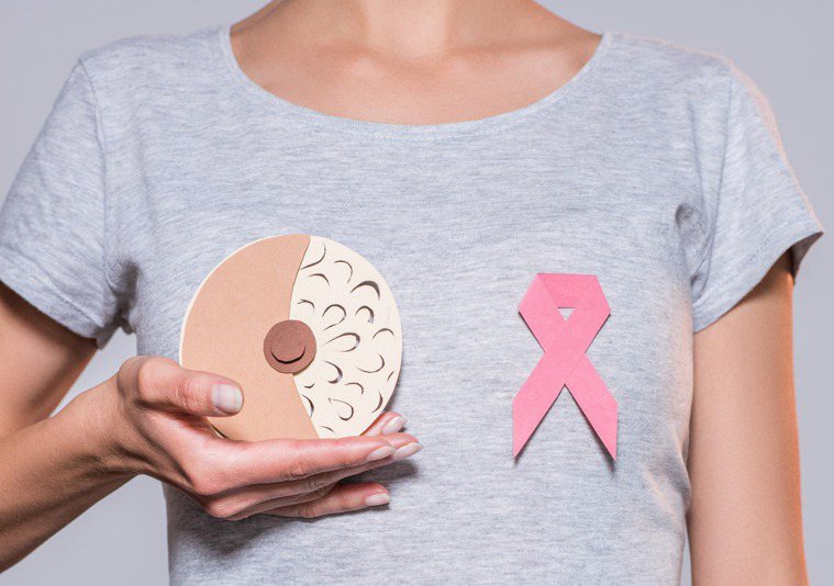乳癌患者示意圖。圖╱123RF