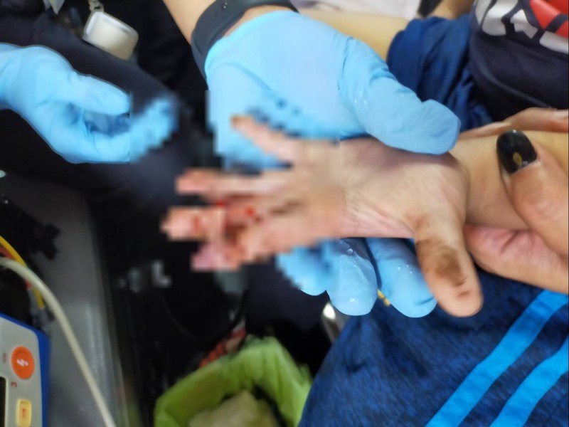 台南家長忙著檸檬收成，孩童遭洗選機鏈條夾傷手指骨折送醫。圖／台南市消防局四大隊提供