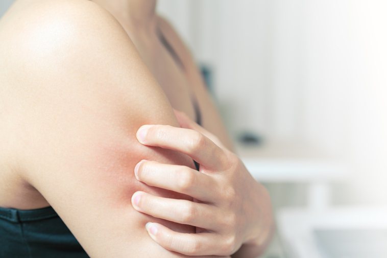 皮膚癢可能是疾病警訊。圖／ingimage