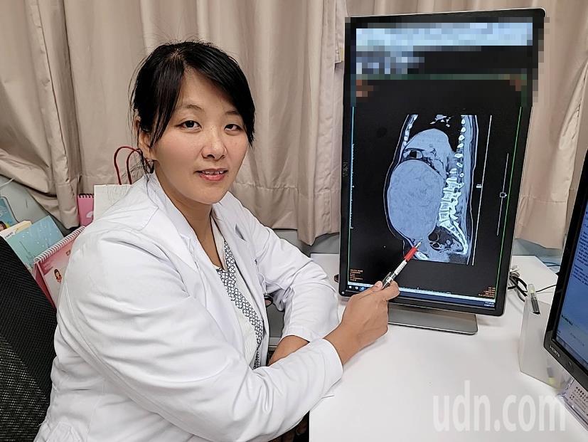 長安醫院醫師魏沛秝說，婦人的子宮肌瘤直徑27公分、重達7.9公斤，比雙胞胎還大。圖／長安醫院提供