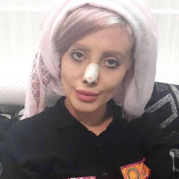 被称为「僵尸版」安洁莉娜裘莉的伊朗少女吉斯凡因为将自己僵尸模样干瘪面容照片上传社群媒体，据报遭判10年徒刑。 图／翻摄自吉斯凡(photo:UDN)