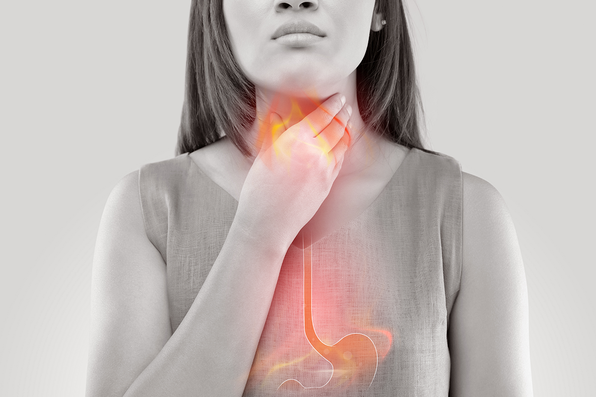 胃酸逆流是現代人常見的胃疾，不只有胸口灼熱的不適感，還可能發生慢性咳嗽，尤其在夜晚躺平的時候。嚴重者還會因為食道發炎而難以吞嚥。