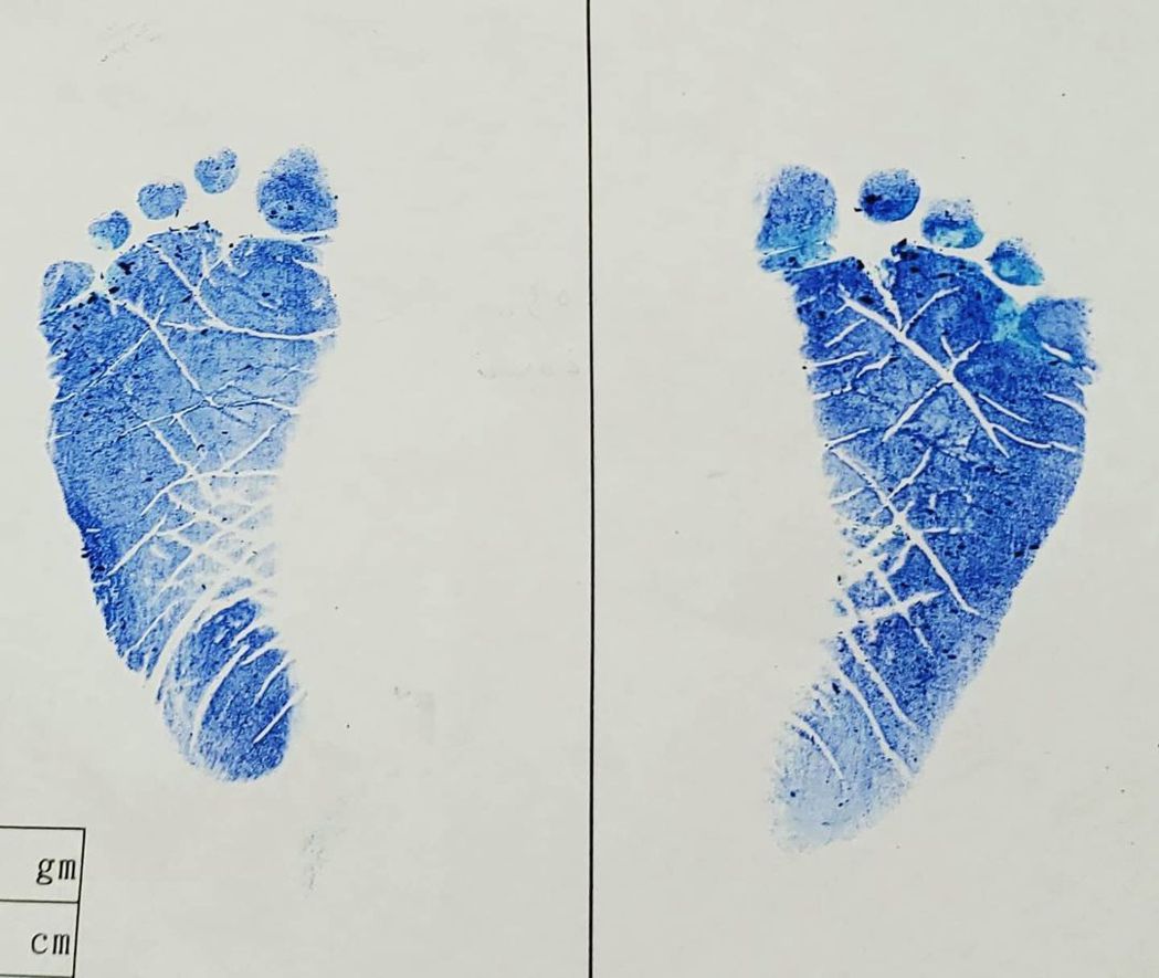 HowHow分享兒子出生的小腳印。 圖／擷自IG