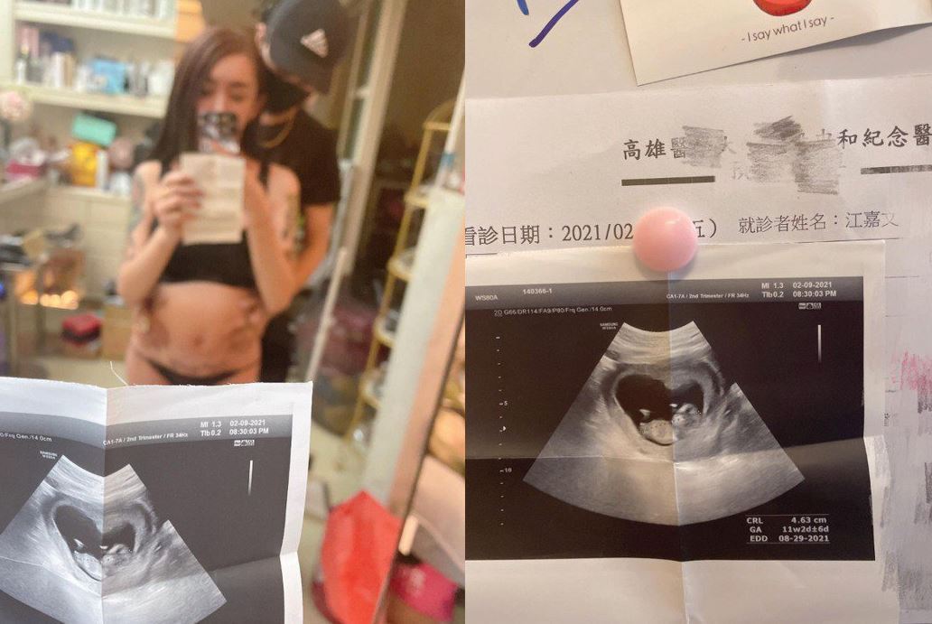 罔腰附上超音波照開心宣布自己懷孕。圖／取自Instagram