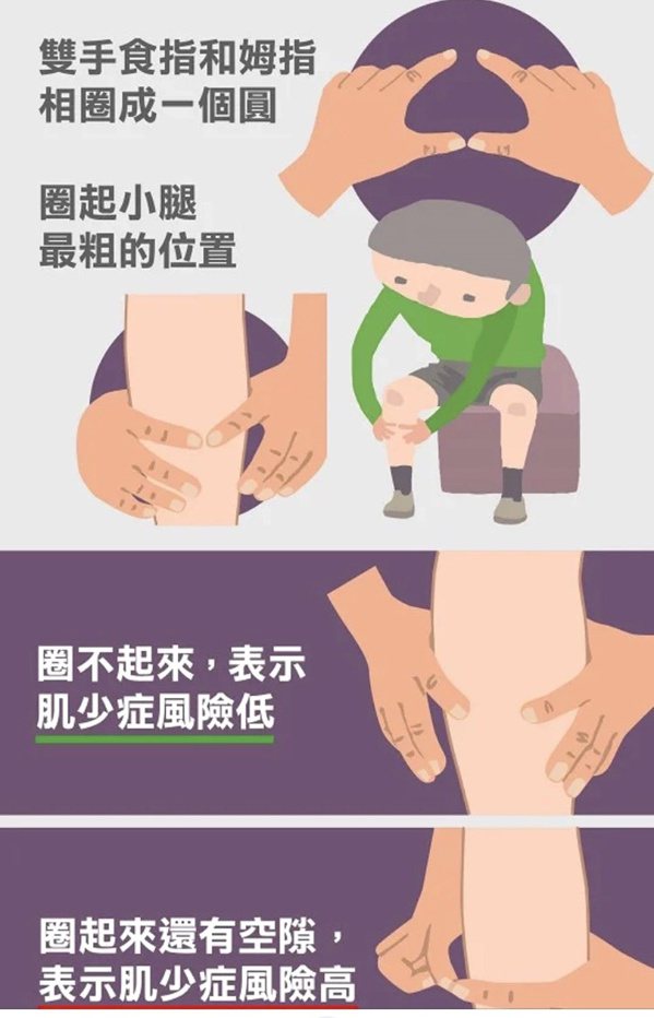 肌少症簡易測檢測方法，用雙手拇指、食指兩手環握量測小腿圍看有無空隙。 圖／鄭明德...