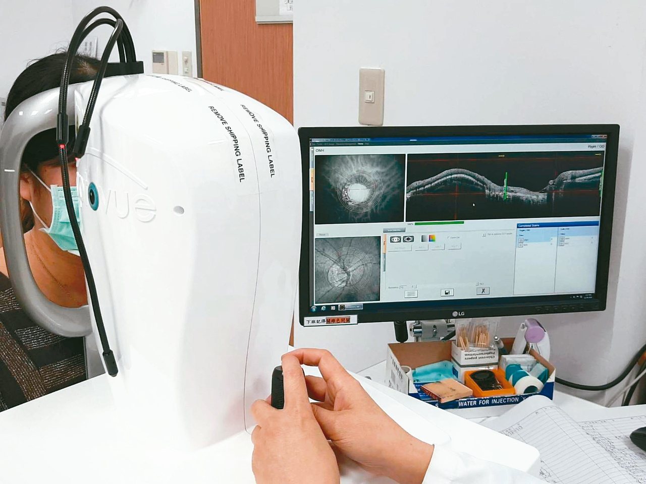 光學斷層掃描血管造影術，藉由分析視神經與黃斑部的血流密度，診斷早期青光眼。圖╱台中榮總眼科提供