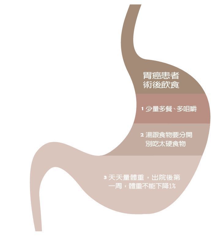 胃癌患者術後飲食 製表/元氣周報 圖/123RF