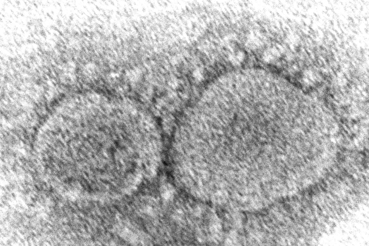 英國科學家歐本肖30日示警新冠病毒正在進化，圖為電子顯微鏡下的病毒模樣。美聯社