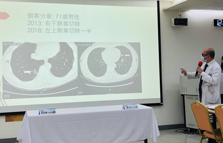 新光醫院胸腔外科主任張益誠分享71歲男性肺癌個案。記者黃惠群／攝影