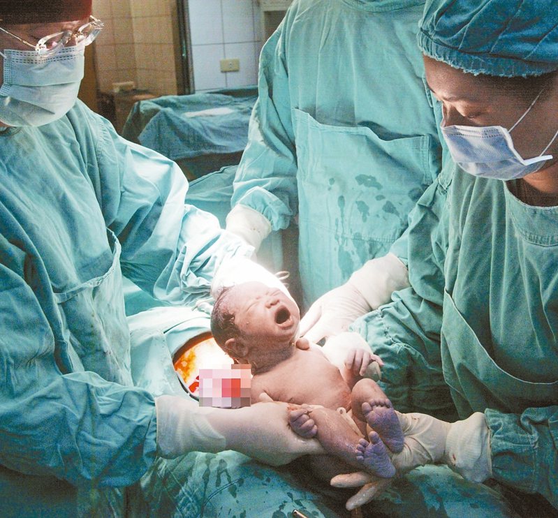 陽明院區護理師懷胎30周卻因救人染疫，上周三因病況危急緊急剖腹生產，圖為示意圖，並非護理師生產情況。聯合報系資料照