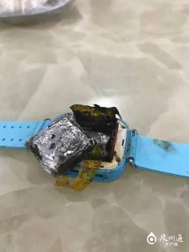 中國大陸福建一名四歲女童佩戴的智慧手錶突然爆炸，導致女童手背燒傷。圖／取自微博
