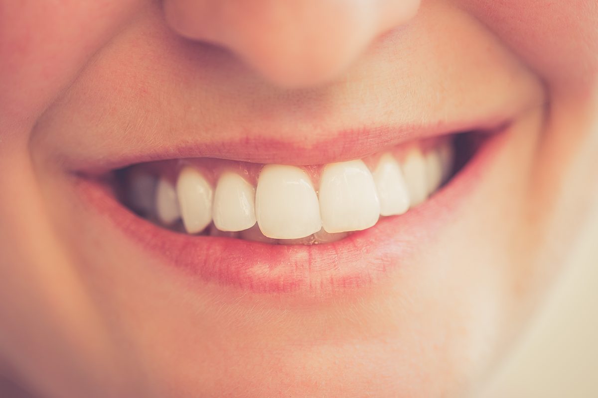 牙齒美白非一勞永逸，牙齒顏色一段時間後會些許回復。減少食用深色食物、三餐飯後確實潔牙、且定期回診檢查，也可搭配使用美白牙膏，讓牙齒的美白效果維持較久。圖／ingimage
