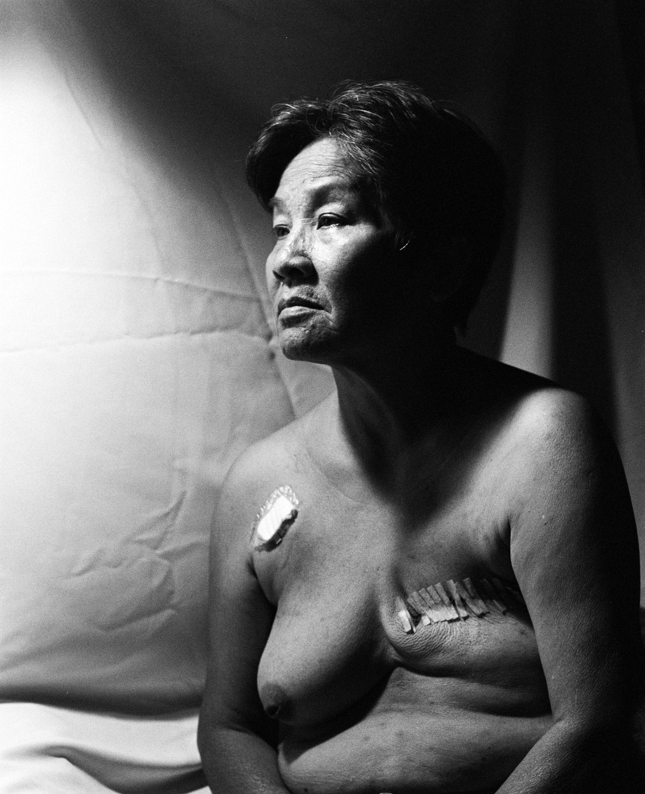 「生命癌殤」一作是攝影師王怡霖的母親，接受癌症手術後兩周所拍攝。圖／王怡霖提供