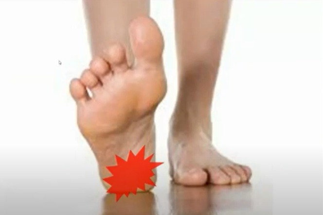 足底筋膜炎是走路時腳底會痛。 圖╱WaCare課程影片提供