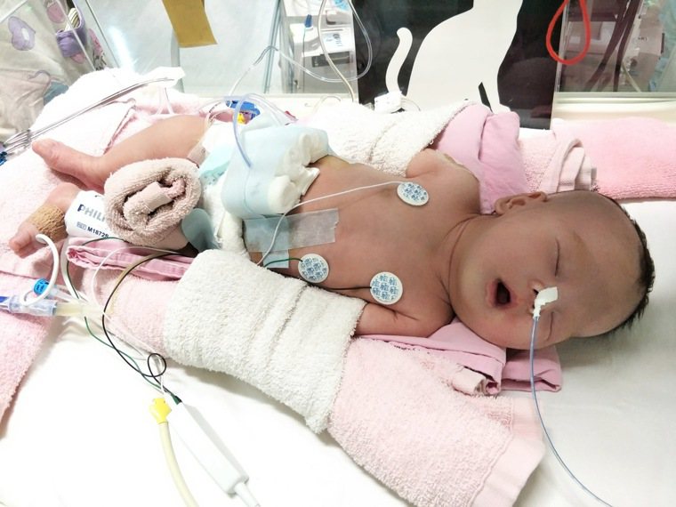 陳小妹出生一周就緊急住院。圖／陳小妹的母親提供