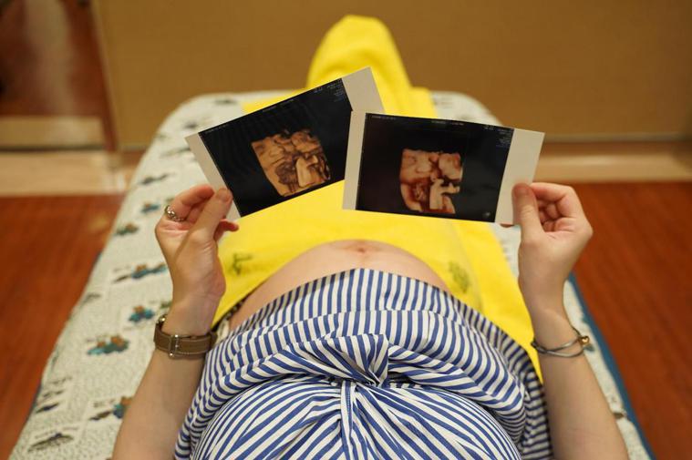 母胎醫學的產前小兒醫學，在懷孕期間即能應用高端影像設備與分子生物科技來診斷胎兒異...