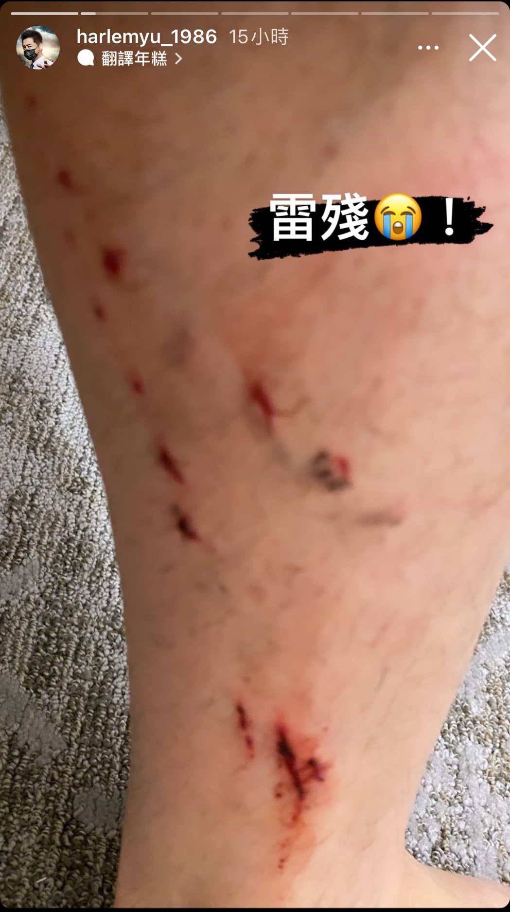 庾澄慶（哈林）疑似騎單車出意外。圖／摘自IG