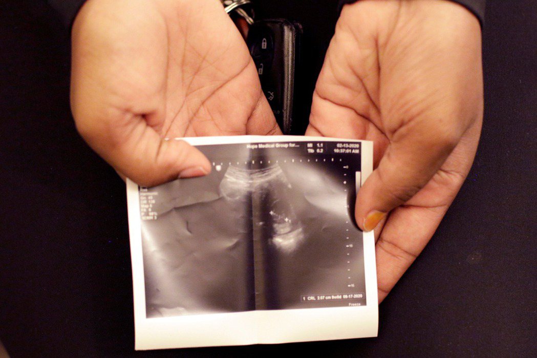 「參議院八號法案」的新法規要求醫師必須「透過就孕期當時來說合理的方式，檢查胚胎是否已經具有心臟活動」，而倘若胚胎已有心臟活動（也就是反墮胎人士所說之「心跳」），則醫師不得為孕婦提供人工流產手術。 圖／路透社