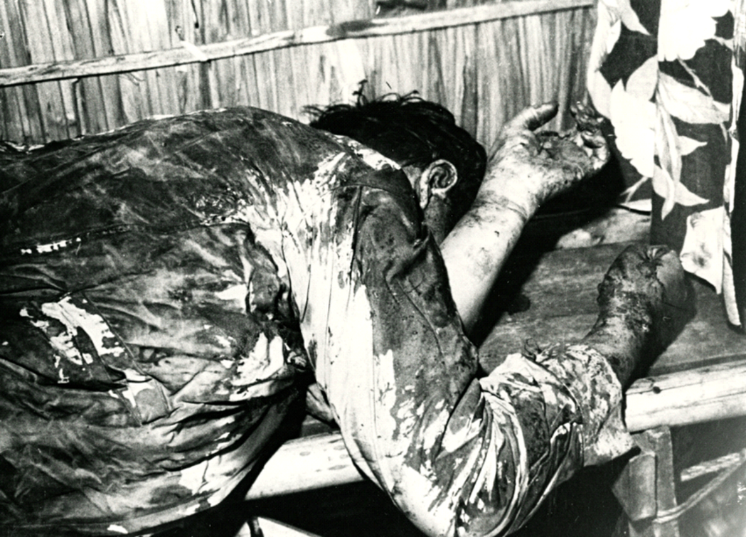 1951年11月，一張紀錄帕迪拉死後慘狀的相片在遭媒體大肆報導之後，拉克森的作為...