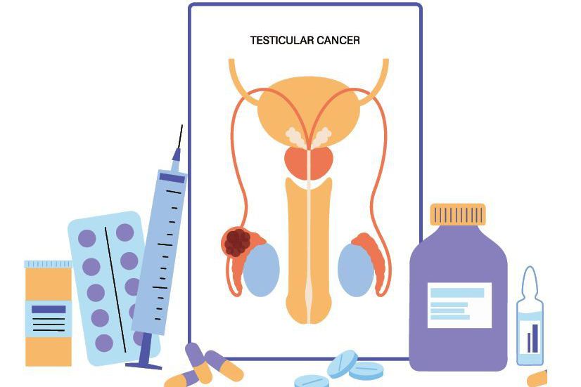 因睪丸癌好發於年輕育齡男性，因此需保留睪丸癌病人生育力。圖/123RF