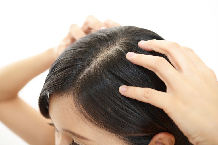 若是不常洗頭，油脂會存積在頭皮上，阻礙毛髮的生長。圖/123RF