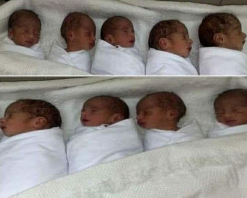 25周就出生的九胞胎，体重介于500至1000公克之间。图撷自每日邮报(photo:UDN)