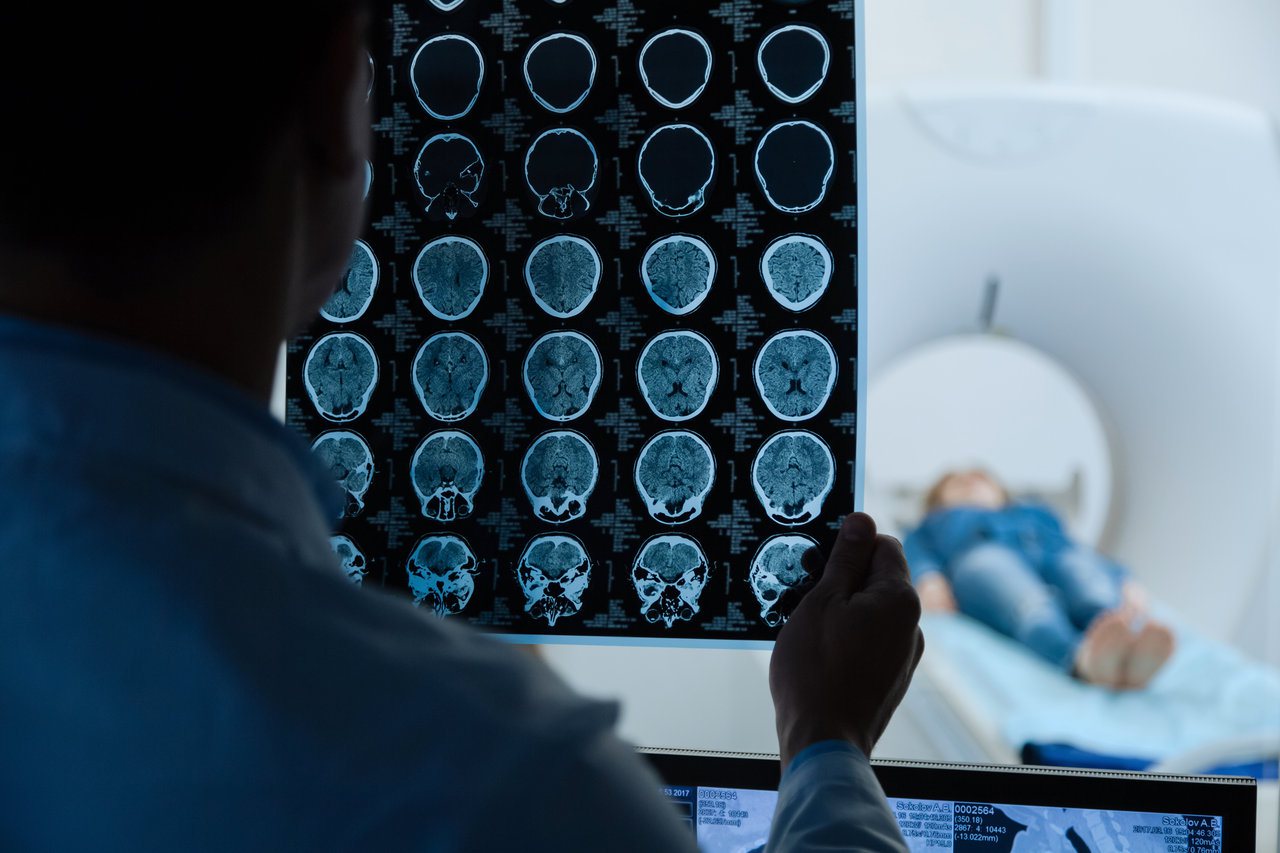 當醫師對疾病有疑慮，需要做進一步的精細影像檢查時，電腦斷層（CT）或磁振造影（MRI）掃描是兩大選項。 圖/123RF