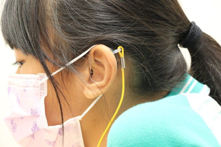 科林助聽器公司聽力師施治渝為胡小妹妹配戴由丹麥進口的迷你機型助聽器 外表幾乎看...
