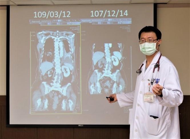麻豆新樓醫院腎臟內科醫師蔡昊澐說明80歲阿嬤「心房顫動」未治療，造成腎臟委縮的個案。圖／麻豆新樓醫院提供
