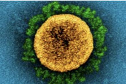新型變種病毒omicron來勢洶洶。圖／維基百科