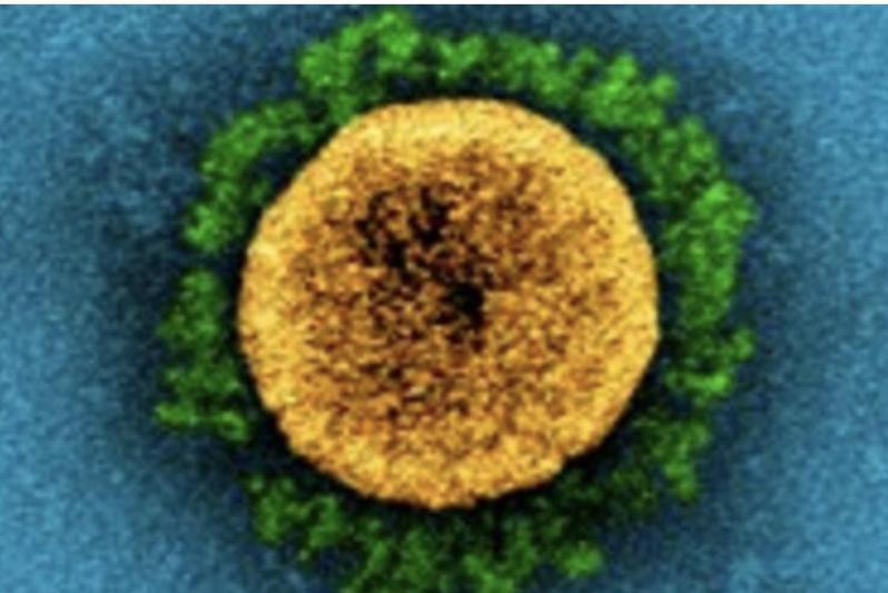 新的新冠肺炎變異株病毒Omicron讓全球聞之色變。圖／維基百科
